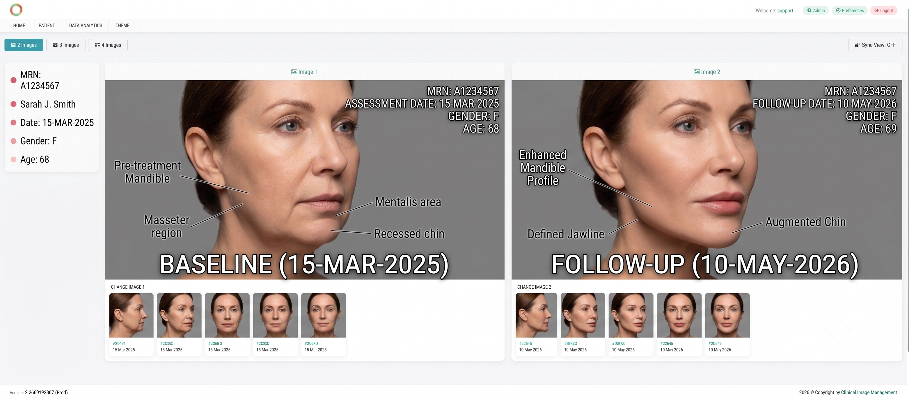 Image Comparison